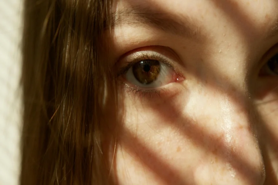 LASIK Recovery Timeline: From Day One to Full Healing LASIK Recovery Timeline
