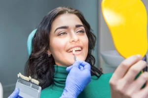 Veneers in Dubai